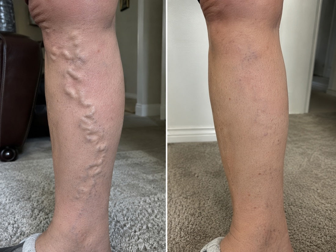 VEYRA customer-submitted before and after photo
