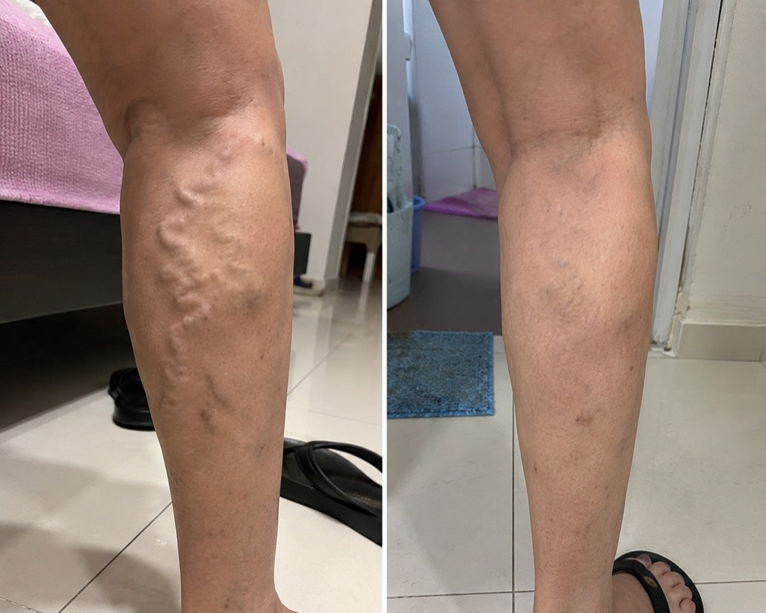 VEYRA customer-submitted before and after photo