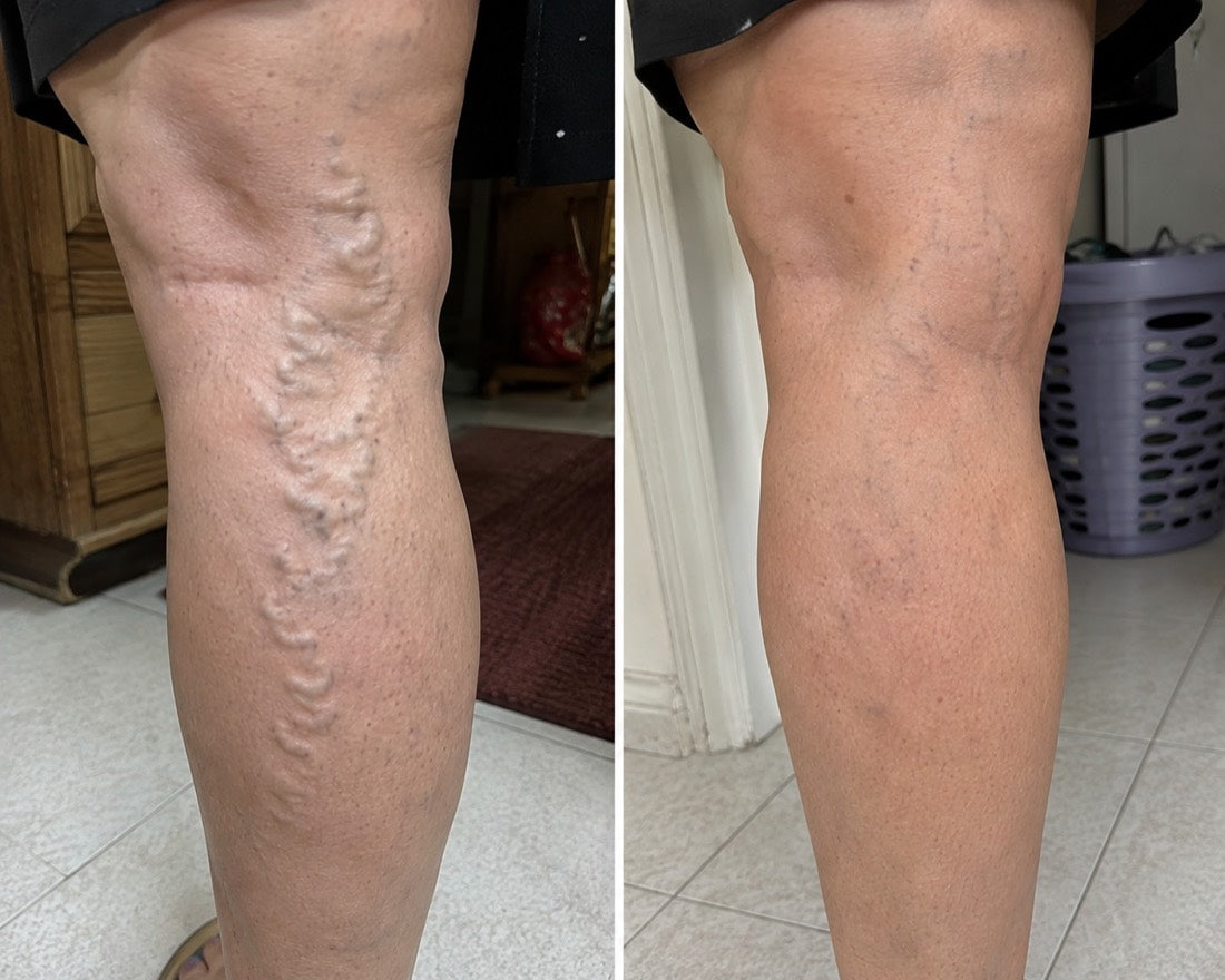 VEYRA customer-submitted before and after photo